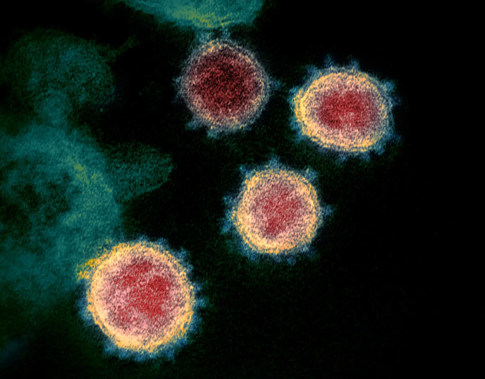 Environmentalists flag public health risk to livestock disease